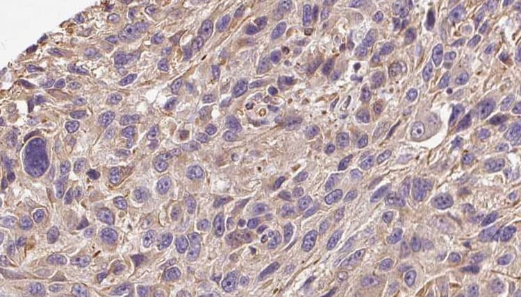 COL19A1 / Collagen XIX Antibody