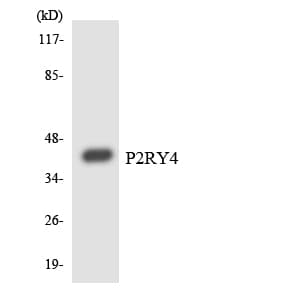 P2RY4 / P2Y4 Antibody (aa149-198)