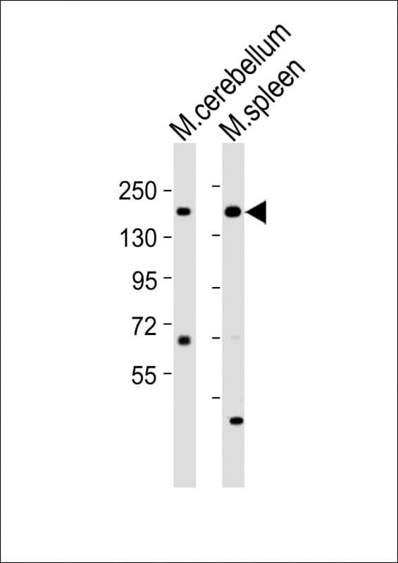 KDM6A / UTX Antibody (aa1041-1074)