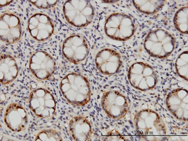 PSMB6 Antibody (clone S51)