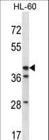 HSD3B1 Antibody (aa26-55)
