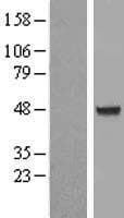 AIPL1 Protein (Over-Expression Lysate Myc-DDK (Flag))