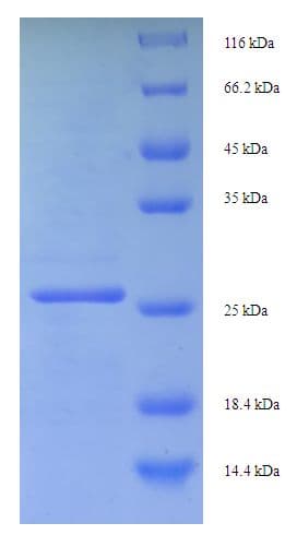 Human EIF4EBP3 Protein (Recombinant His-SUMO)