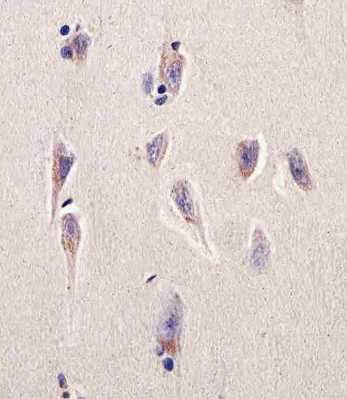 DHFR Antibody (aa16-30)