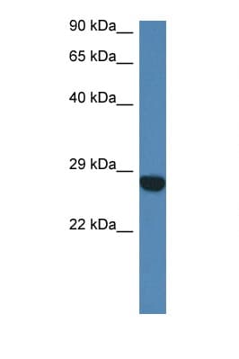 CCDC90B Antibody (aa40-89)