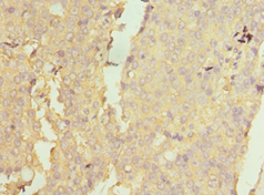 Polyclonal Rabbit anti-Human NAA10 / ARD1A Antibody (aa161-235, IHC, WB)