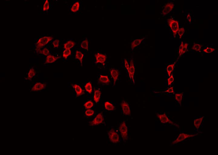 Polyclonal Rabbit anti-Human MST1R / RON Antibody (IF, WB)