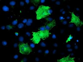 EPN2 Antibody (clone OTI1B4, Carrier-free)