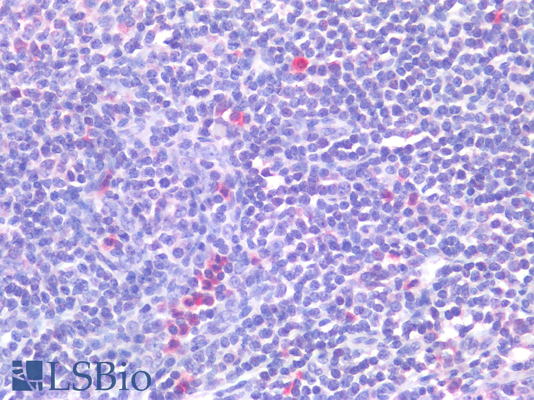 IHC-plus™ Polyclonal Rabbit anti-Human CD63 Antibody (IHC)
