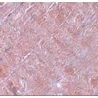 RANBP10 Antibody