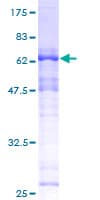 Human SAP30BP / HTRG Protein (Recombinant GST)