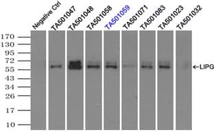 Monoclonal Mouse anti-Human LIPG / Endothelial Lipase Antibody (clone OTI3C4, Carrier-free, IHC, IF, WB)