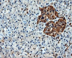 Heat Shock Protein 70 / HSPA1A Antibody (clone OTI1B2)