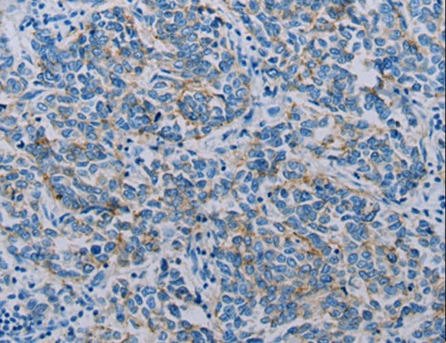 CLDN4 / Claudin 4 Antibody