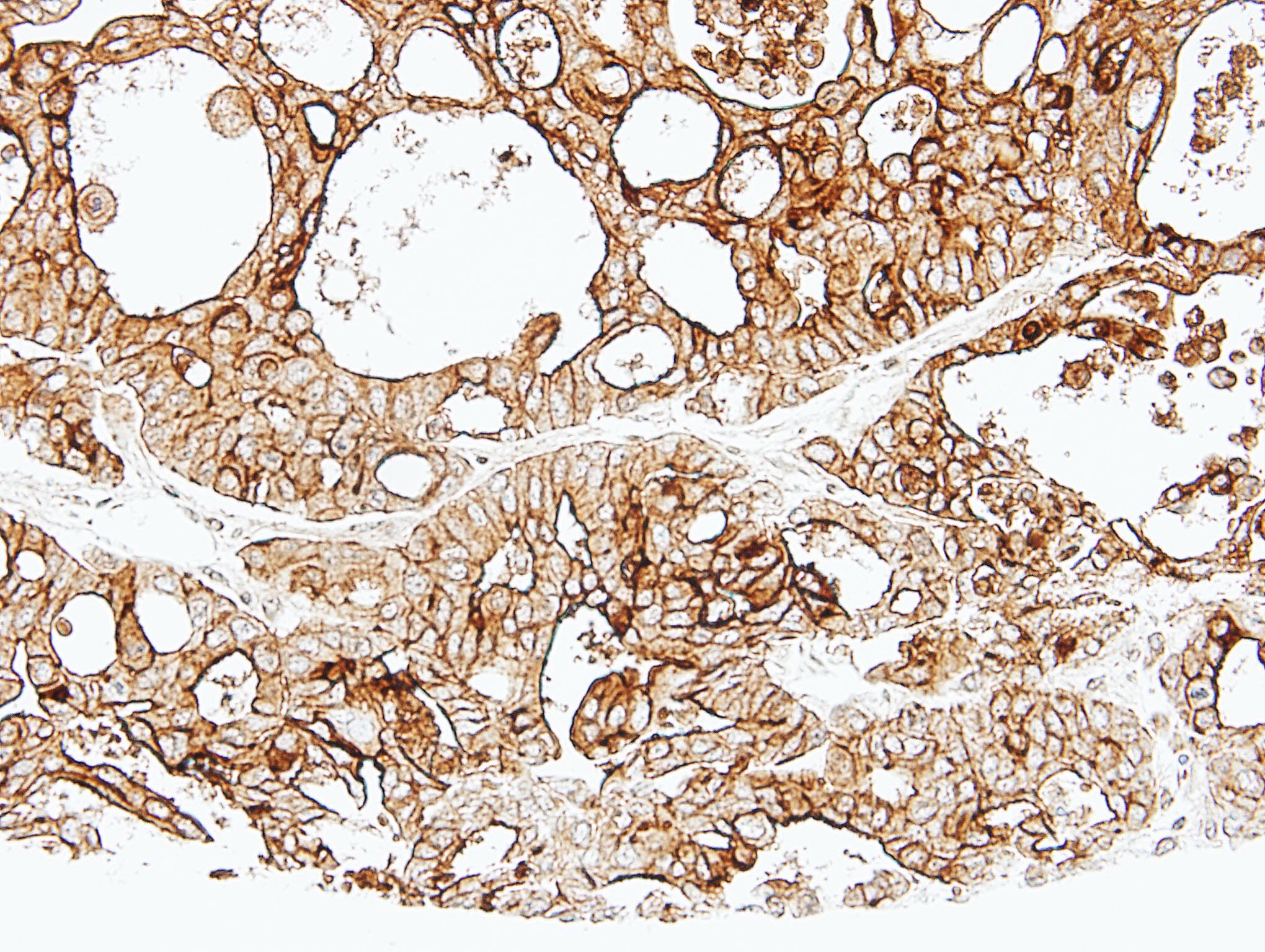 Polyclonal Rabbit anti-Human ALPPL2 Antibody (aa46-344, IHC, WB)