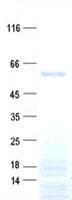 Human DMRTA1 Protein (Recombinant His, N-Terminal)
