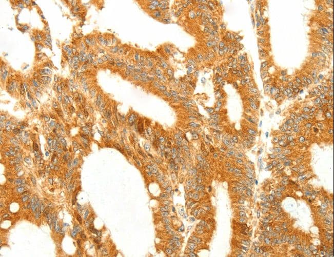 DIABLO / SMAC Antibody