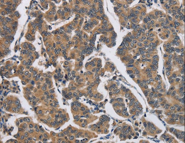 DHRS3 / SDR1 Antibody