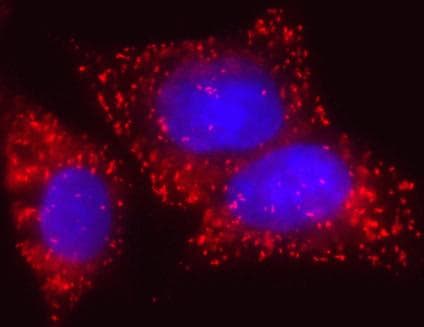 Monoclonal Mouse anti-Human EHHADH / Enoyl-Coa Hydratase Antibody (clone 7F6AF11, IF)