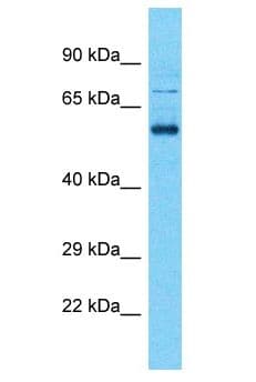 Polyclonal Rabbit anti-Human SHISA7 Antibody (aa220-269, WB)