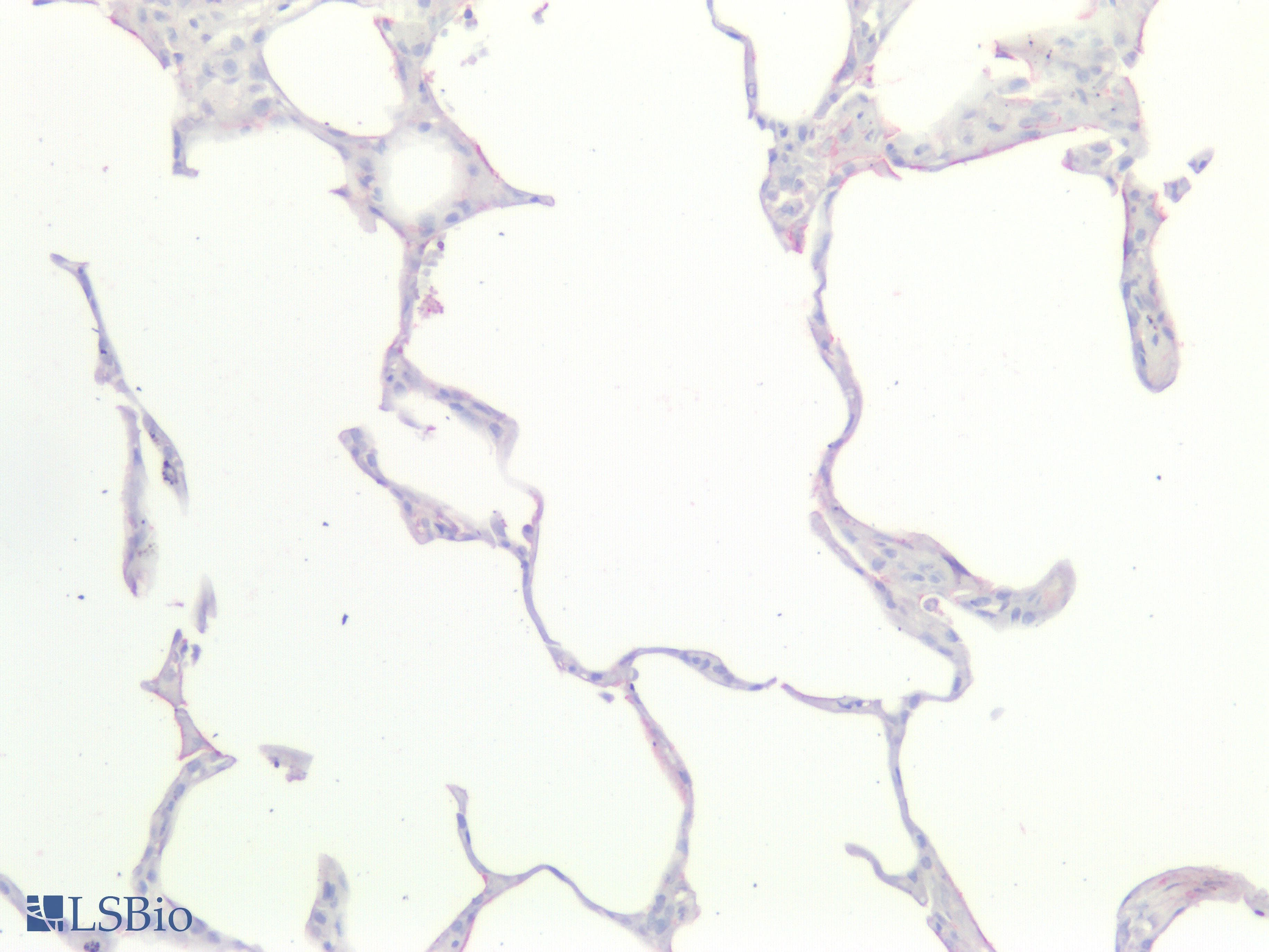 IHC-plus™ KRAS Antibody