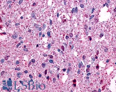 PathPlus™ CCR10 / GPR2 Antibody (Extracellular Domain)