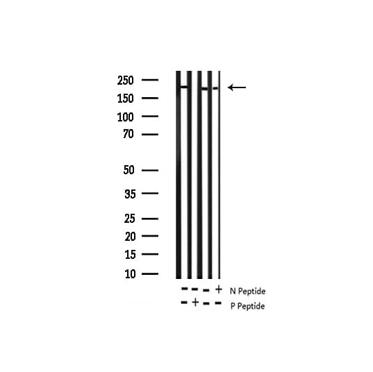 Polyclonal Rabbit anti-Human BRCA1 Antibody (phospho-Ser1423, IHC, WB)