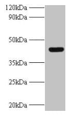 IHC-plus™ UBE2Q2 Antibody (aa1-375)
