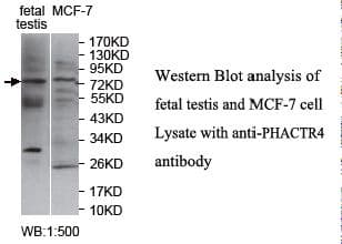 PHACTR4 Antibody (aa139-378)