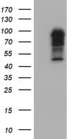BIRC3 / cIAP2 Antibody (aa255-529, clone OTI1F5)