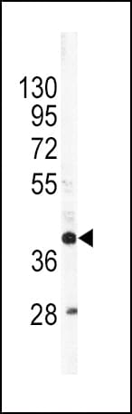 Polyclonal Rabbit anti-Human APOL1 / Apolipoprotein L Antibody (aa369-398, IHC, WB)