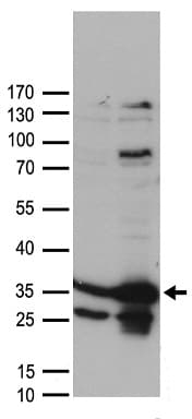 CSNK2B / Phosvitin Antibody