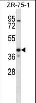Polyclonal Rabbit anti-Human TWIK1 / KCNK1 Antibody (aa263-292, WB)
