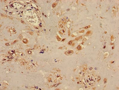 TINF2 Antibody