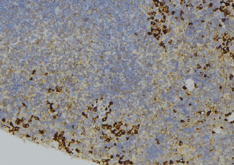 Polyclonal Rabbit anti-Human IL6R / IL6 Receptor Antibody (IHC, WB)