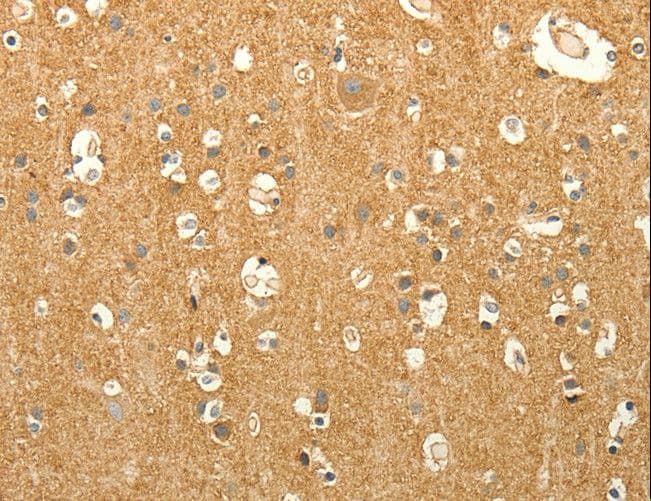 Polyclonal Rabbit anti-Human LPAR3 / LPA3 / EDG7 Antibody (IHC)