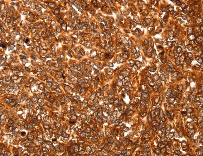Polyclonal Rabbit anti-Human ALDOA / Aldolase A Antibody (IHC, WB)