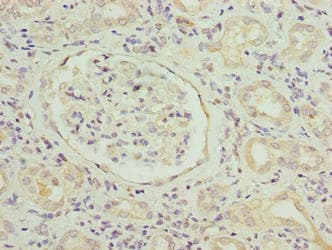 SLITRK4 Antibody