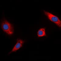 Polyclonal Rabbit anti-Human RSK1 + RSK2 + RSK3 Antibody (C-Terminus, IHC, IF, WB)