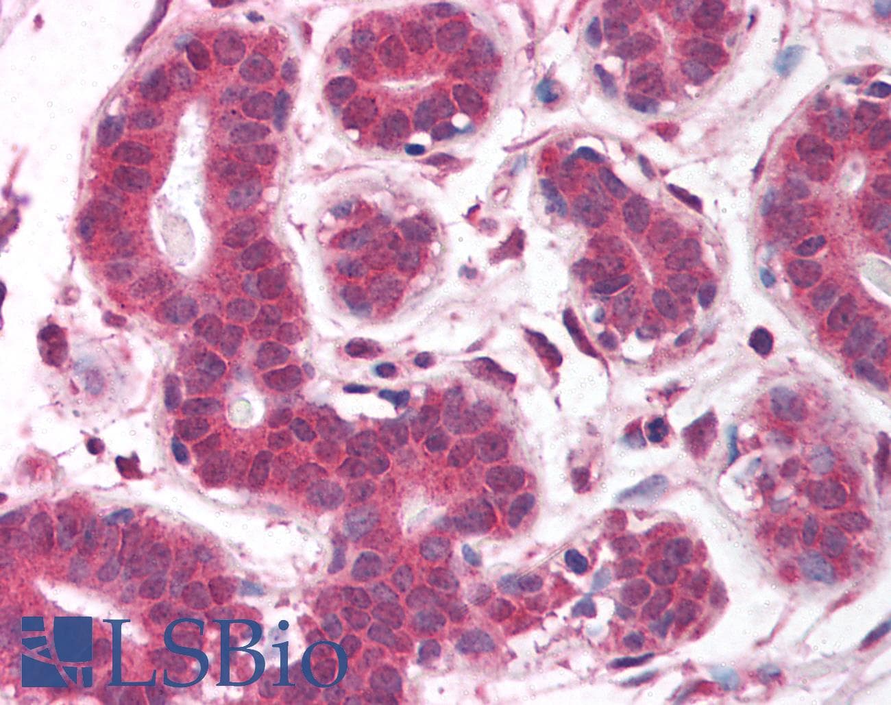 Polyclonal Rabbit anti-Human EGLN2 / PHD1 Antibody (aa58-107, IHC, WB)