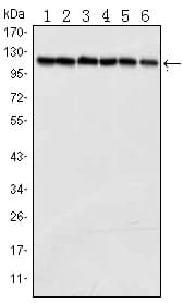Monoclonal Mouse anti-Human PARP1 Antibody (clone 7A10, WB)