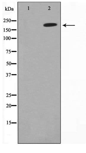 Polyclonal Rabbit anti-Human Collagen IV Antibody (IHC, WB)