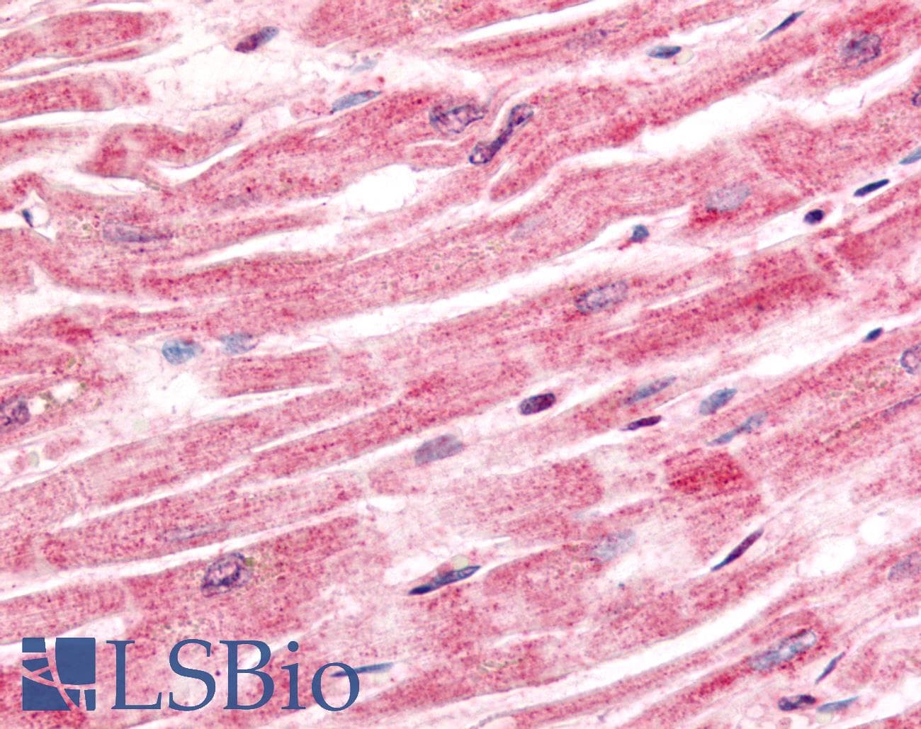 IHC-plus™ Polyclonal Rabbit anti-Human Sprouty 4 / SPRY4 Antibody (aa275-299, IHC, WB)