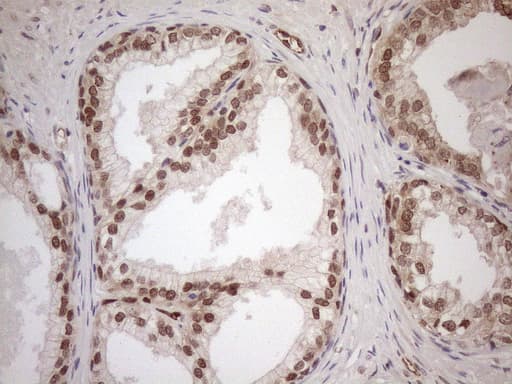 MGMT Antibody (clone OTI10H9)