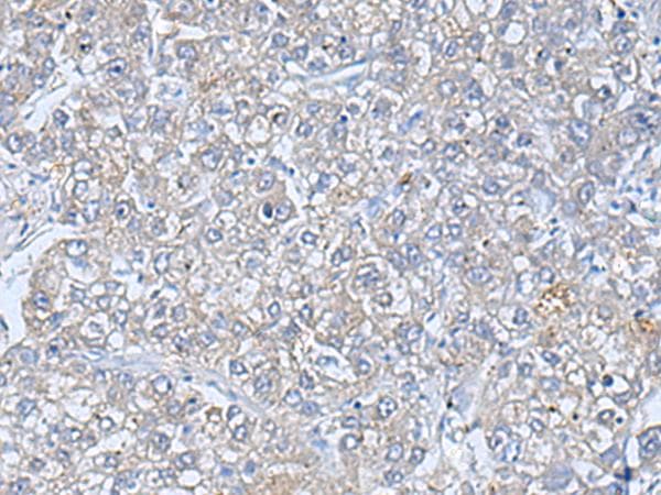 TREM1 Antibody