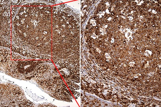 Monoclonal Mouse anti-Human RPSA / Laminin Receptor Antibody (clone OTI1G3, aa2-295, IHC, WB)