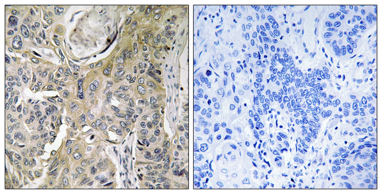 RHOBTB3 Antibody (aa335-384)