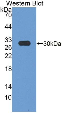 HMG-CoA Reductase / HMGCR Antibody (aa638-887)