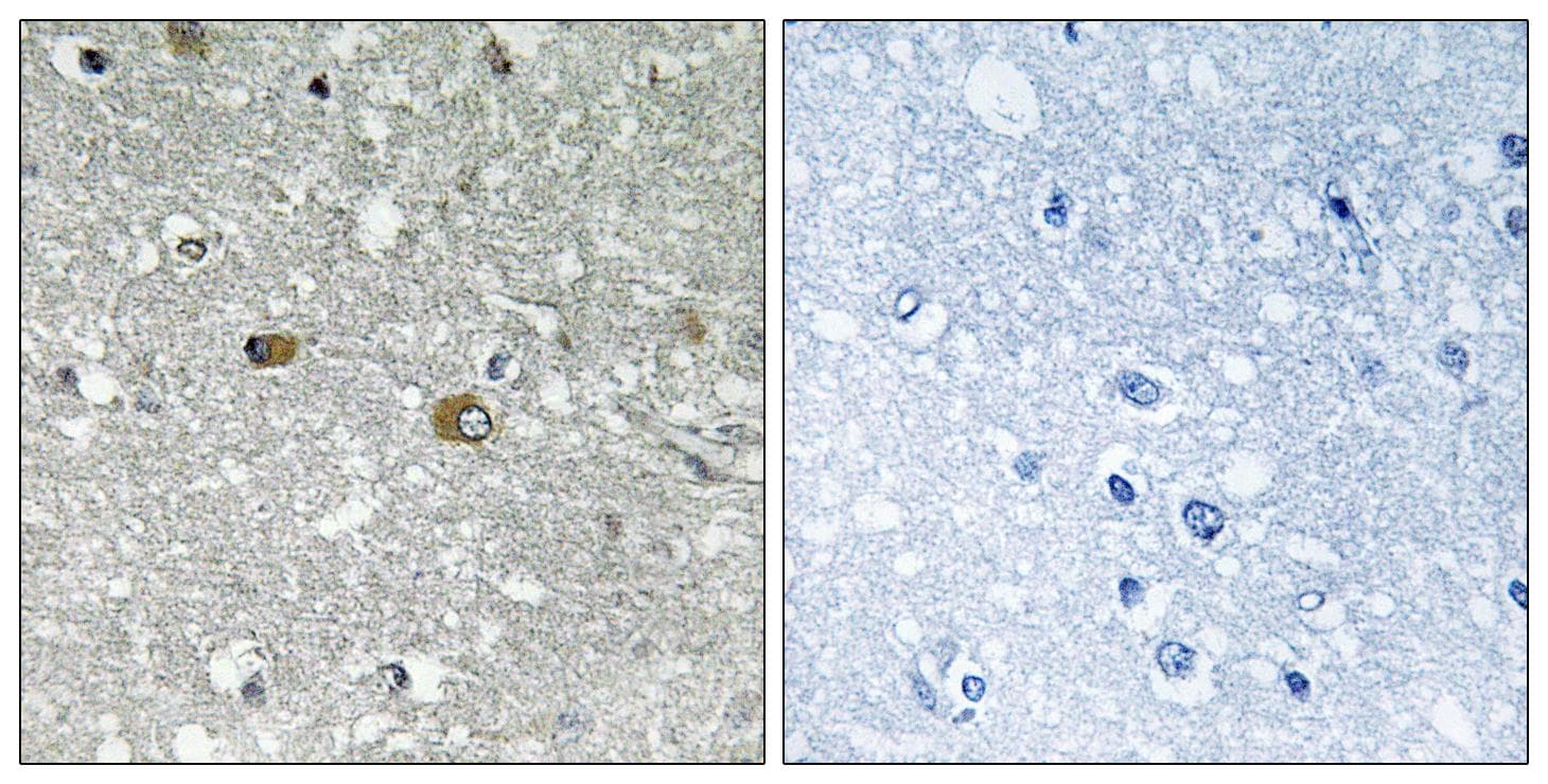 Polyclonal Rabbit anti-Human PIGH Antibody (IHC)