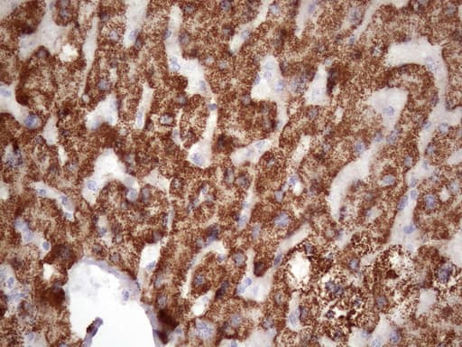 GLYAT Antibody (clone OTI4D1)